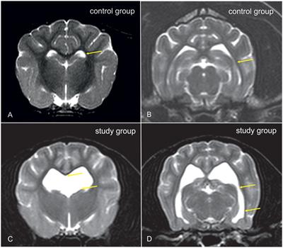 Dynamic Susceptibility Contrast Perfusion Magnetic Resonance Imaging Demonstrates Reduced Periventricular Cerebral Blood Flow in Dogs with Ventriculomegaly